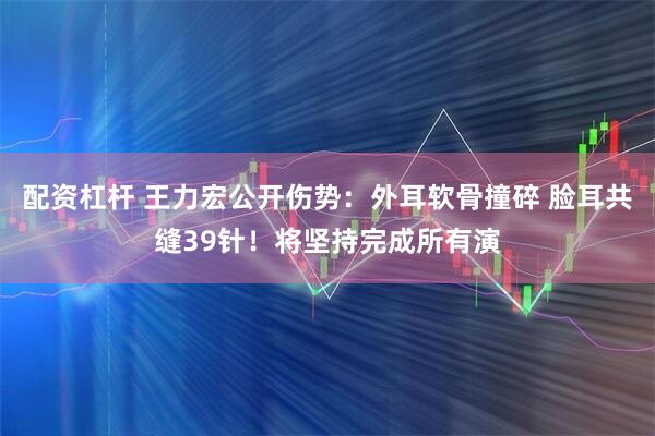 配资杠杆 王力宏公开伤势：外耳软骨撞碎 脸耳共缝39针！将坚持完成所有演